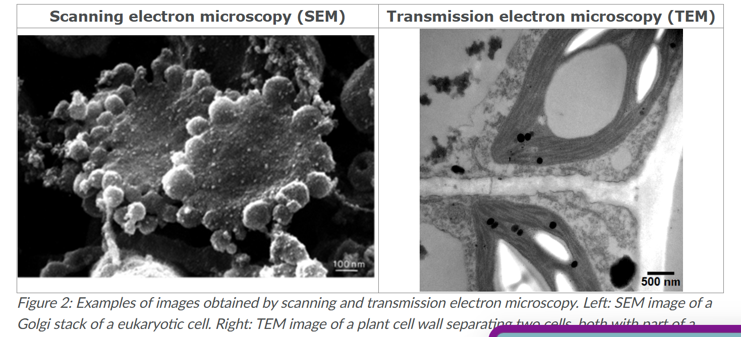 <p>Transmission electron microscopy</p><p>uses very t<strong>hin slices of a specimen</strong>, onto which an e<strong>lectron beam</strong> falls. Whether electrons are transmitted onward to the observer by the sample generates the final image.</p><p></p><p>When preparing samples for TEM, often <strong>contrasting agents </strong>are added. This is necessary because there is hardly any appreciable difference in scattering or absorption of electrons present in biological specimens; Without this, only images met very low contrast between structures would be obtained. Such contrasting agents are often based on heavy metals like lead and uranium, because they strongly interact met the electrons.</p>