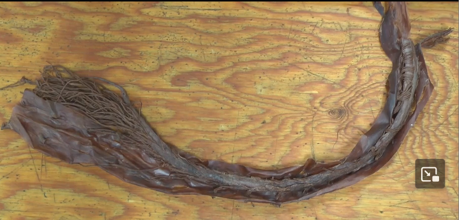 <p>The structure that exits the foramen magnum, extends through the vertebral canal, and terminates between T12 and L3.</p>