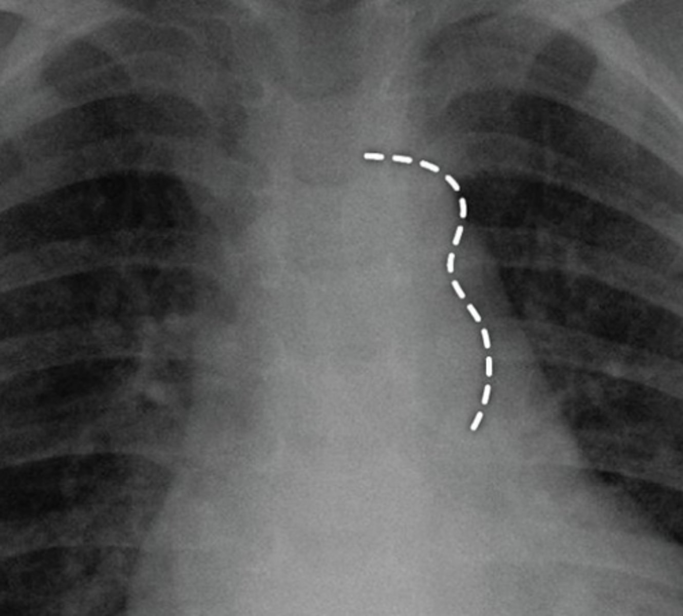 <p>Figure 3 sign.</p>