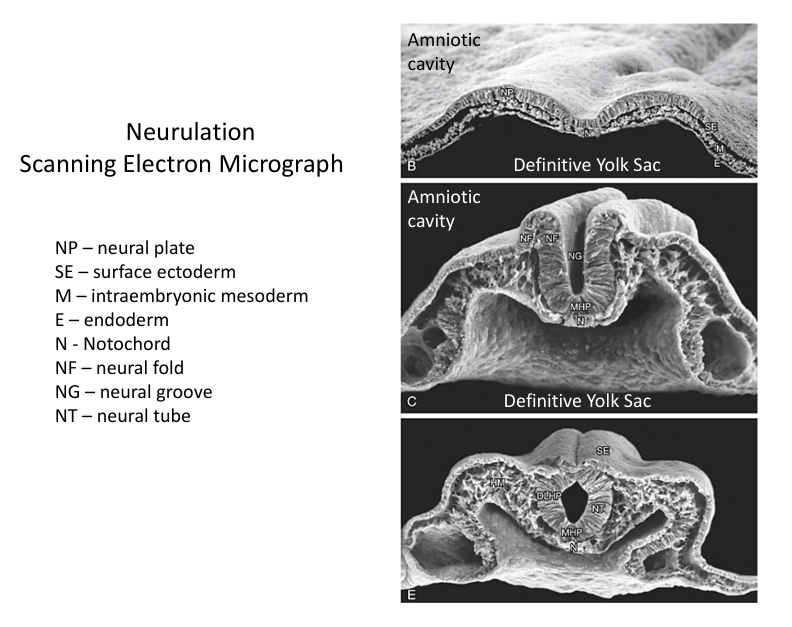 MHP: median hinge point
DLHP: dorsal lateral hinge point
