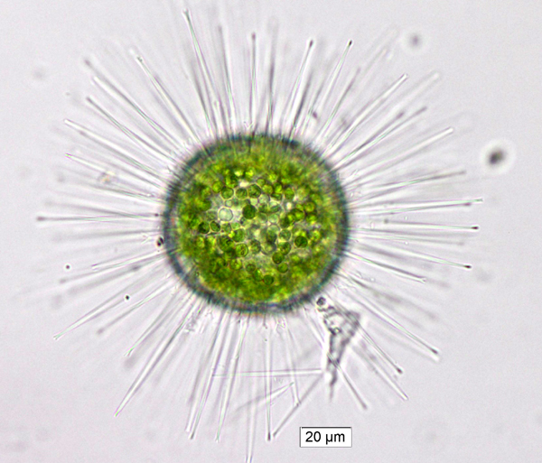 <p><strong>Phylum Heliozoa</strong></p>