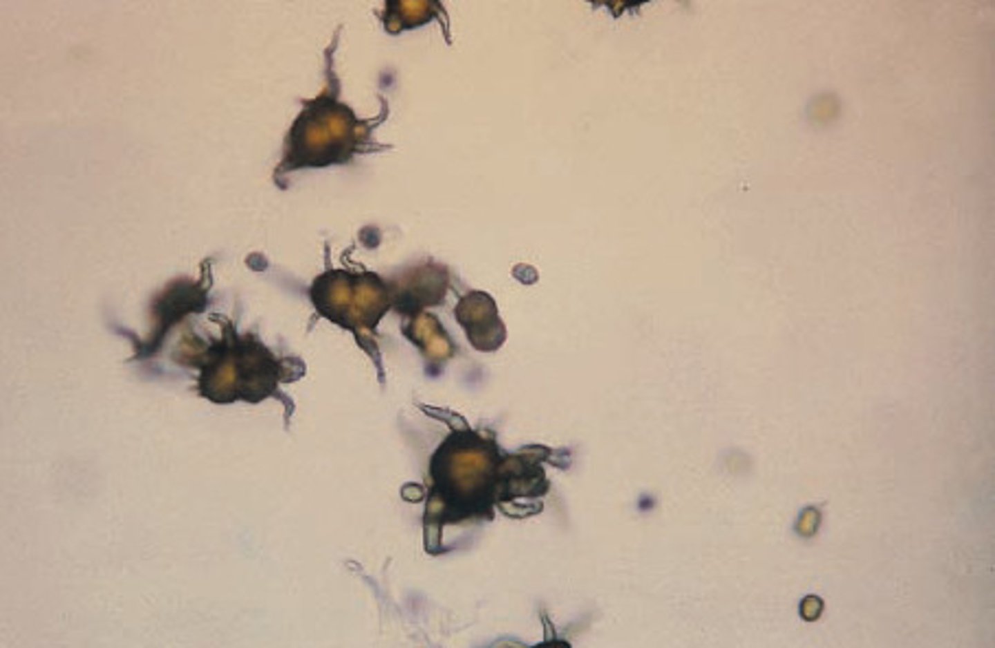 <p>brown in color with long, irregular spicules</p>
