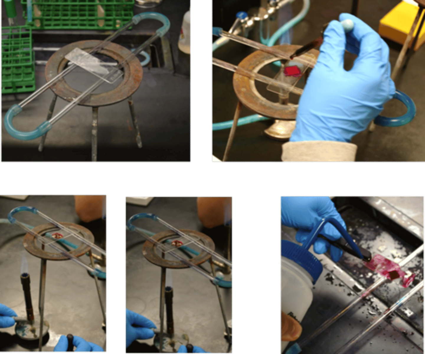 <p>This procedure is for</p>