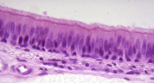 <p>Function: Secretion and propulsion of mucus</p><p>Location: Lining of ducts, ciliated: lines trachea and most of upper respiratory tract</p><p>Characteristics:</p><ul><li><p>Has goblet cells that secret mucus & is ciliated</p></li><li><p>Looks layered, but only has a single layer of cells</p></li></ul><p></p>