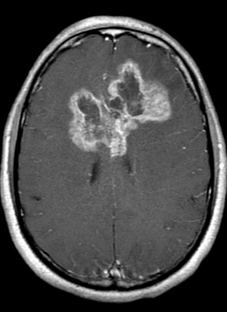 <p>What does this refer to **<span style="color: red;"><strong>PICTURE WILL BE ON EXAM</strong></span></p>