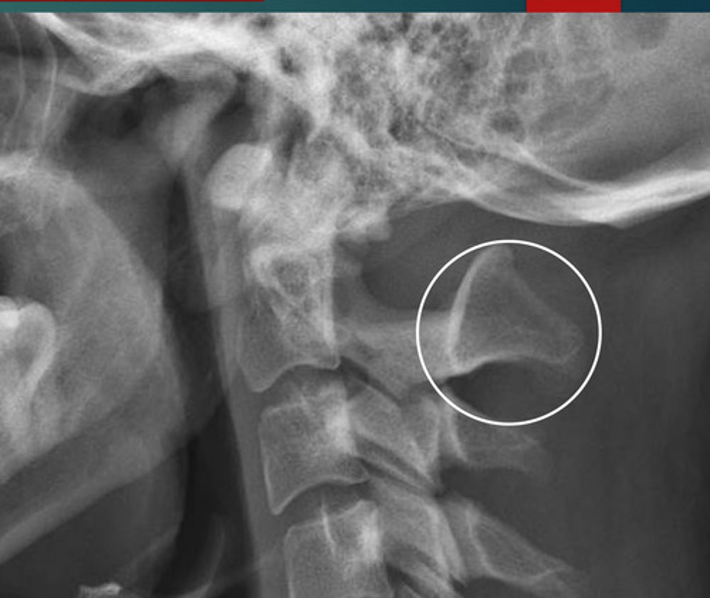 <p>What anomaly is this?</p>