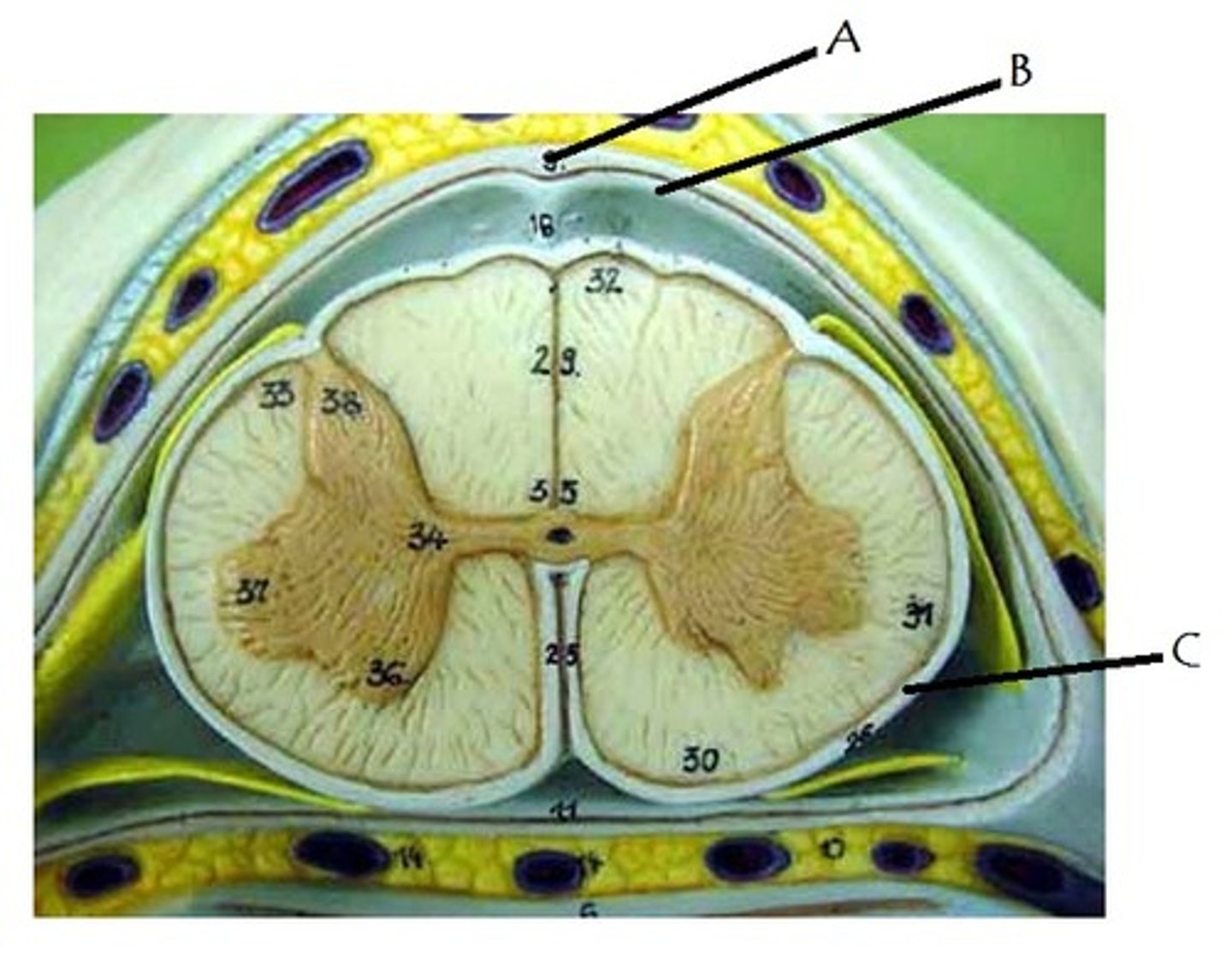 <p>middle layer of the meninges</p><p>B on model</p>