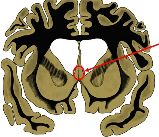 <p>_____ ____ serve as relay of afferent cholinergics (acetylcholine) from ______ to hypothalamus, functions in ____ rage and _____ _____, also has efferent connections to _____ cortex </p>