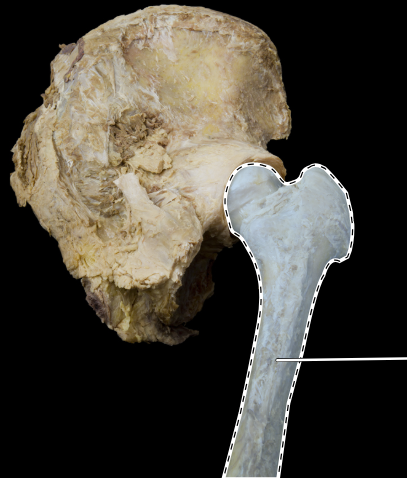<p>Hip joint</p>