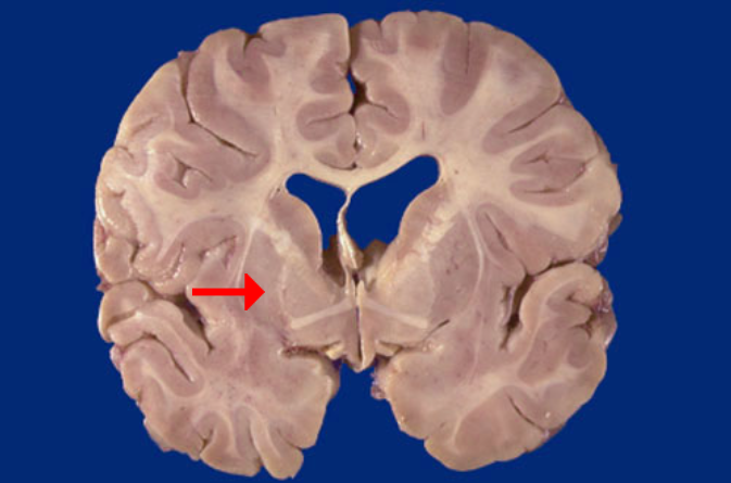<p>Label this brain structure</p>