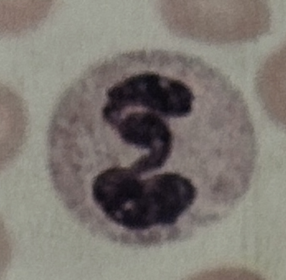 <p>WBC</p>