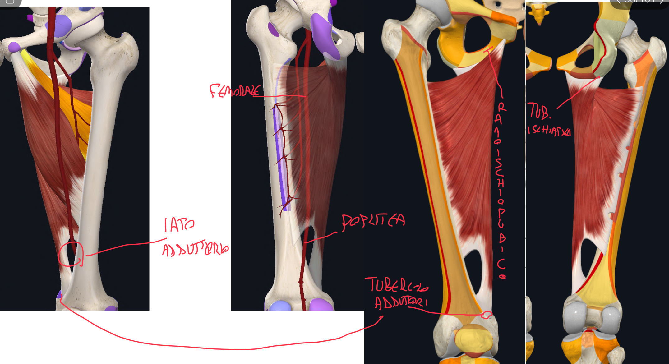 <p>Parte Adduttoria:</p><ul><li><p>Origine → superficie esterna ramo ischiopubico</p></li><li><p>Inserzione → Tuberosità glutea, linea aspra, linea sovracondiloidea mediale</p></li><li><p>Funzione → adduzione coscia (anche lieve flessione coscia)</p></li><li><p>Innervazione → nervo otturatore</p></li></ul><p>Parte Estensoria:</p><ul><li><p>Origine → tuberosità ischiatica</p></li><li><p>Inserzione → tubercolo degli adduttori sull’epicondilo mediale del femore</p></li><li><p>Funzione → estensione coscia</p></li><li><p>Innervazione → nervo ischiatico</p></li></ul><p>IATO ADDUTTORIO:</p><ul><li><p>Tra le due inserzioni, si forma lo iato adduttorio attraversato da Arteria e Vena Femorale</p></li><li><p>Questi vasi, dal compartimento anteriore, passano dietro nella fossa poplitea come arteria e vena poplitea</p></li></ul><p></p><p></p>