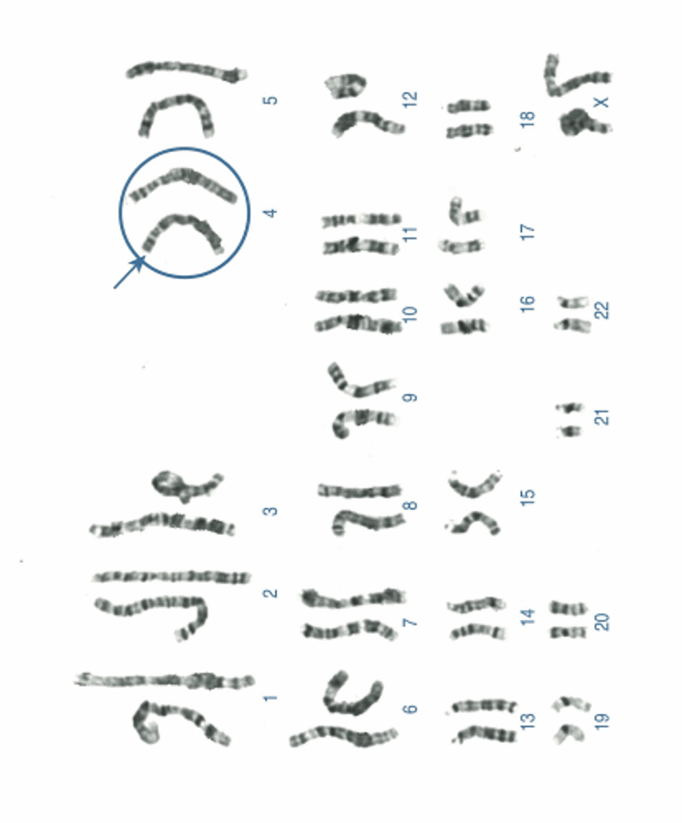 <p>Name:</p><p>- Correctly written karyotype</p><p>- Common name</p><p>- Scientific name</p><p>- One distinguishing clinical feature</p><p>- Definition of this feature if not obvious</p>