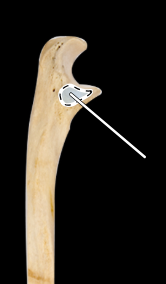<p>Ulna, lateral view, right side</p>