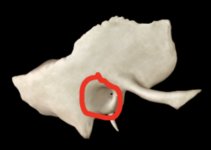 <p>What part of the temporal bone is this?</p>