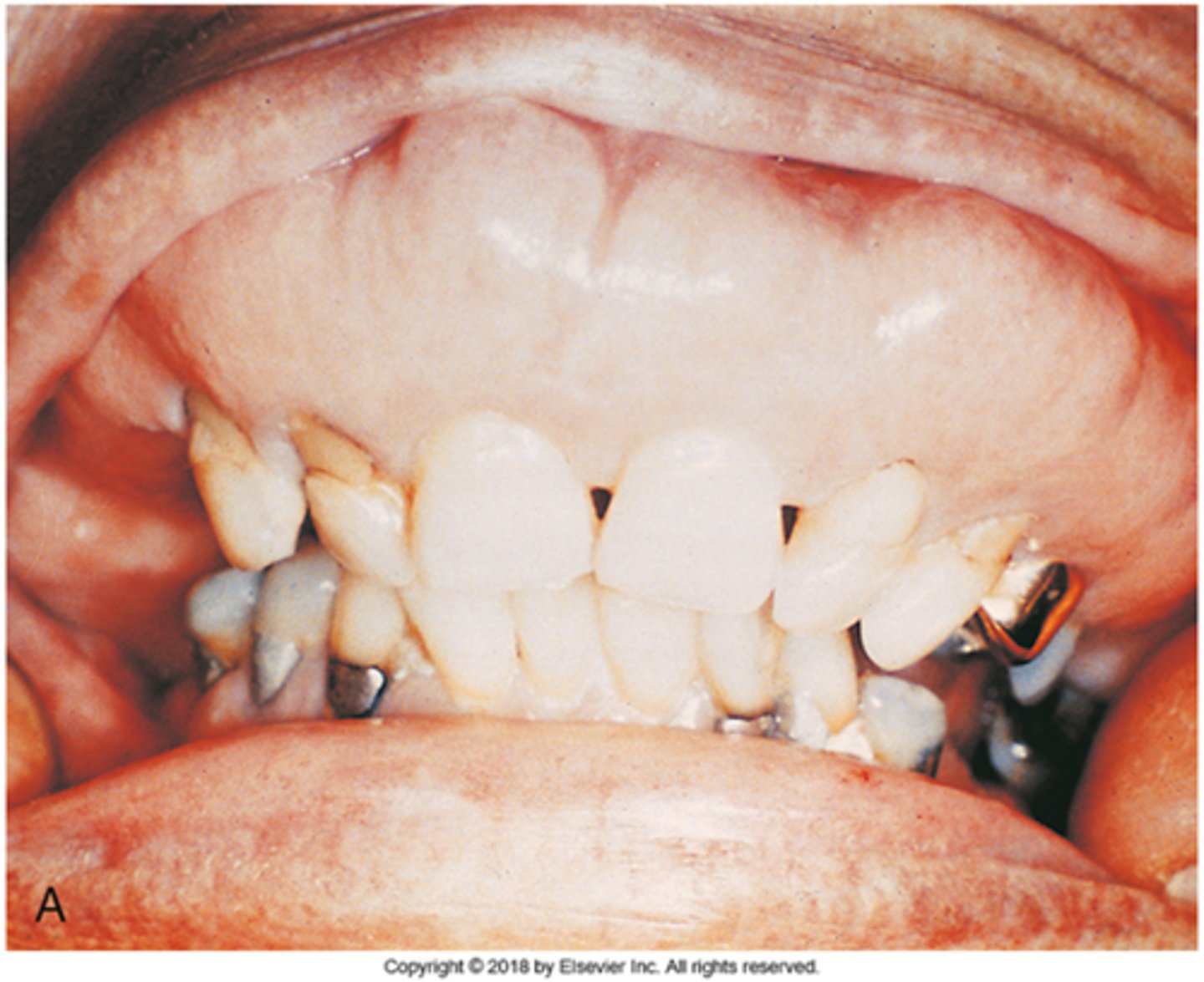 knowt flashcard image