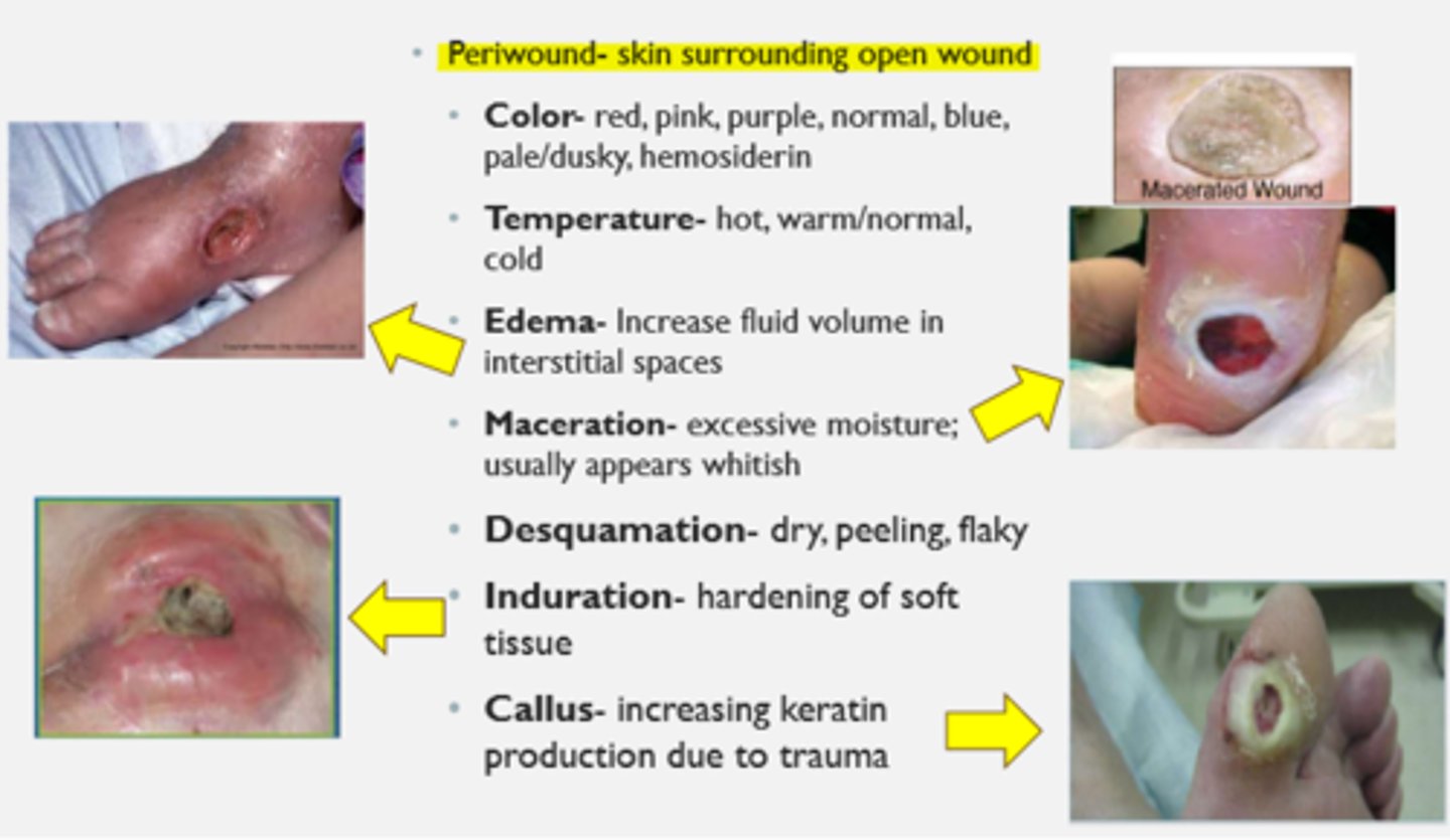 <p>skin surrounding open wound</p><p>- color: red, pink, purple, normal, blue, pale/dusky, hemosiderin</p><p>- temperature: hot, warm/normal, cold</p><p>- edema: increase fluid volume in interstitial spaces</p><p>- maceration: excessive moisture, appears whitish</p><p>- desquamation: dry, peeling, flaky</p><p>- induration: hardening of soft tissue</p><p>- callus: increasing keratin production due to trauma</p>