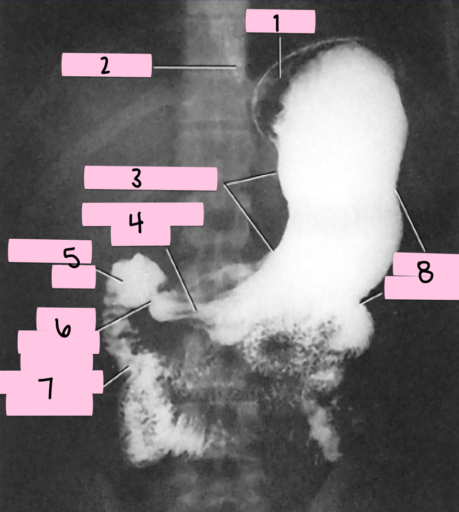 <p>What is 7 pointing to?</p>