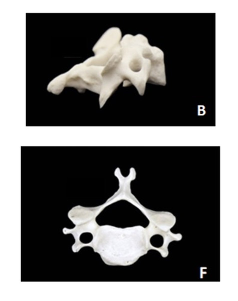 <p>ID the vertebra and view</p>