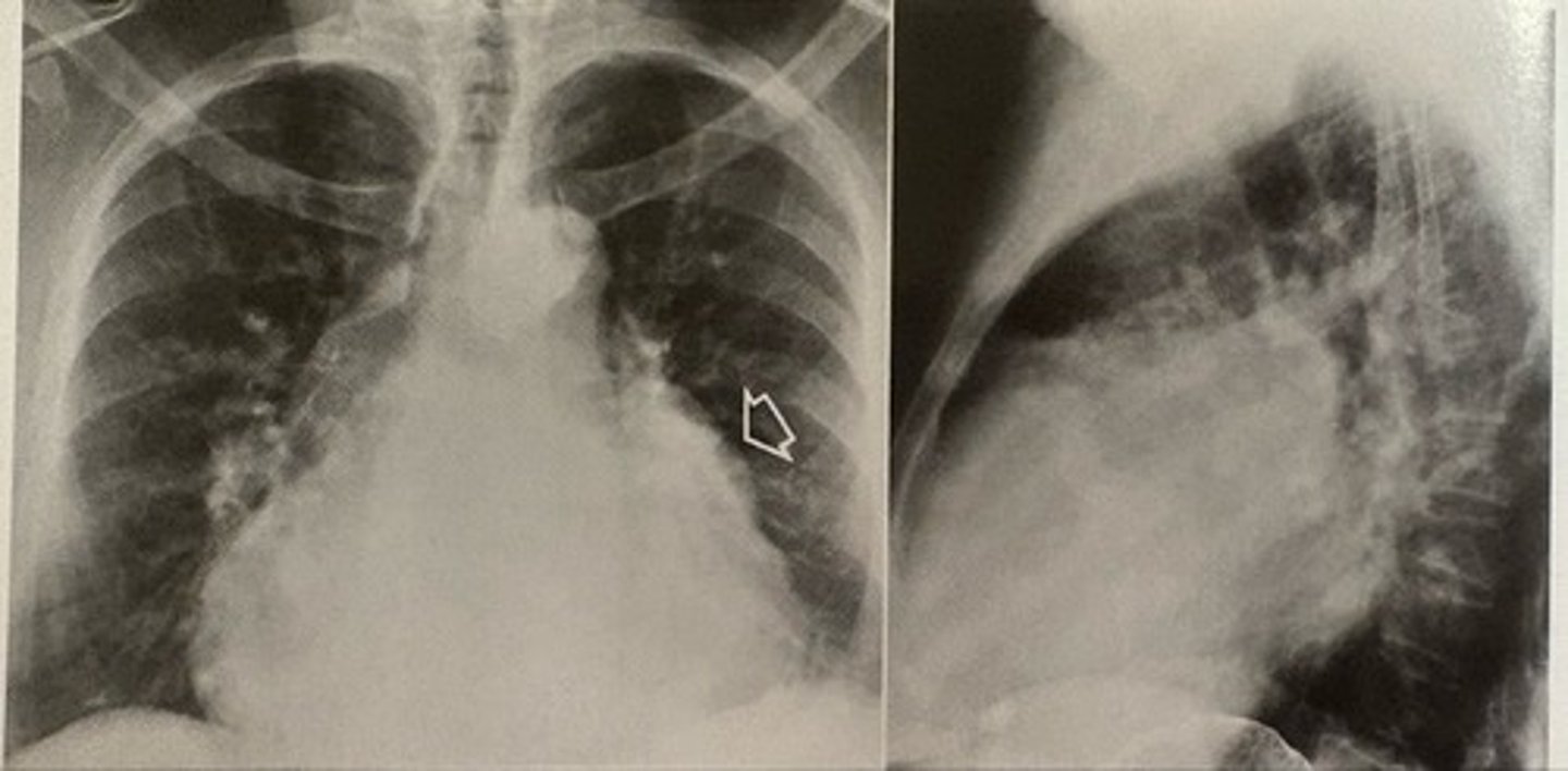 <p>what pathology is present?</p>