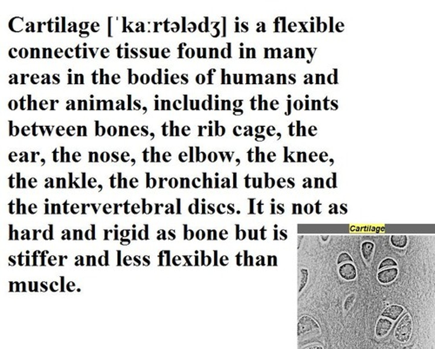 <p>cartilage</p>