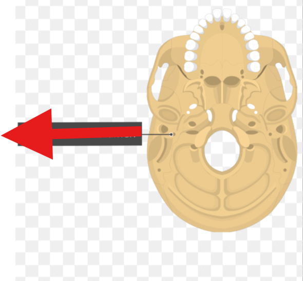 <p>What landmark in the <strong>Temporal Region </strong>is this?</p>