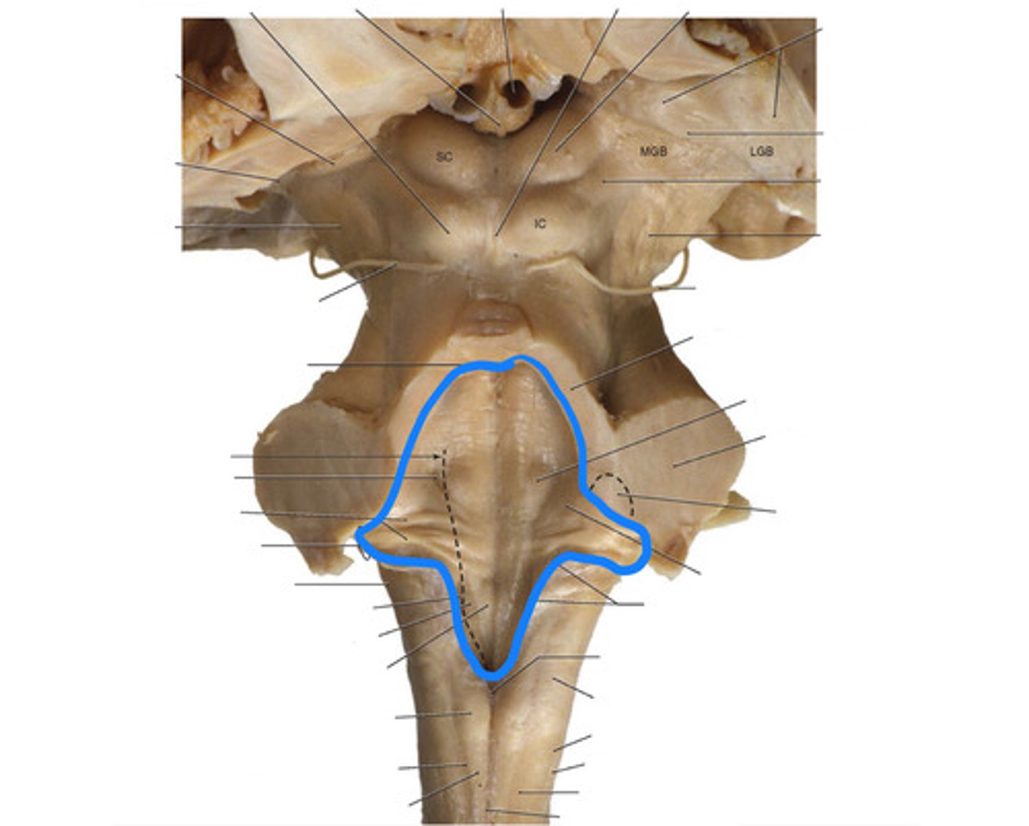 <p>rhomboid fossa</p>