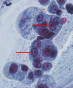 term image