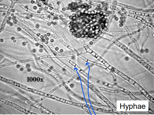 <p>What are the blue arrows pointing to?</p>