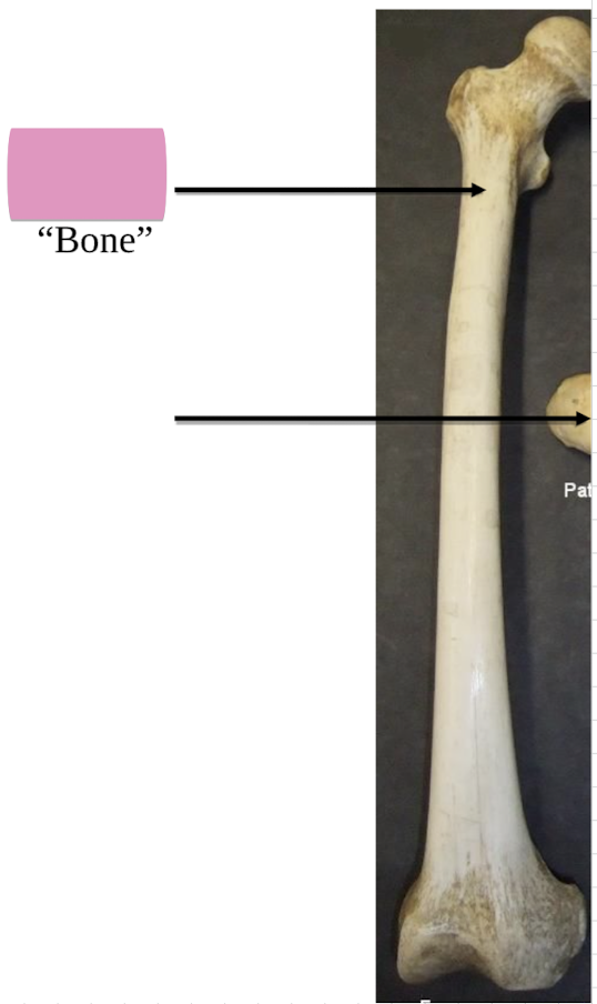 <p>Name the bone </p>