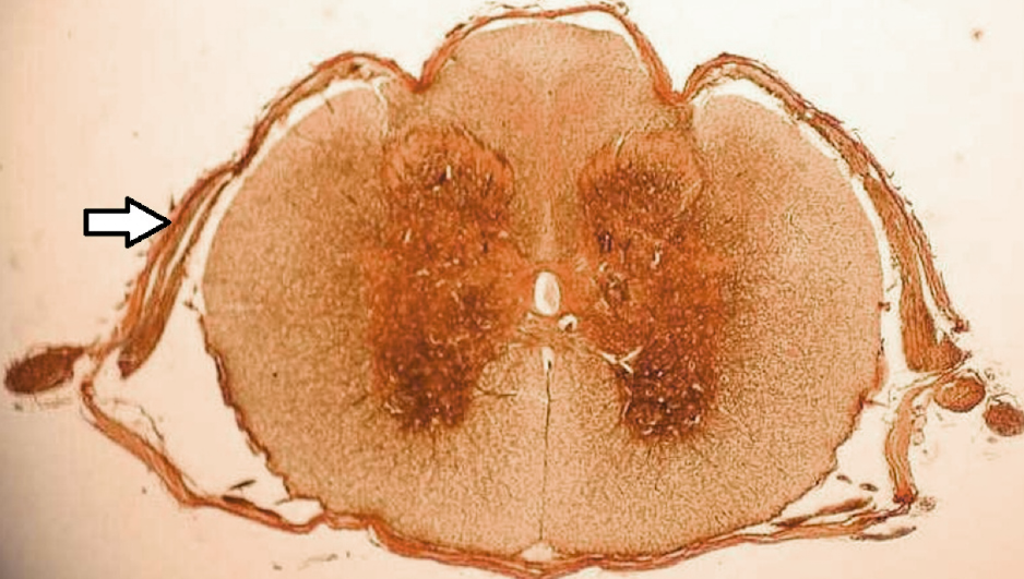 <p>identify the structure</p>