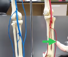 <p>Name the blood vessel.</p>