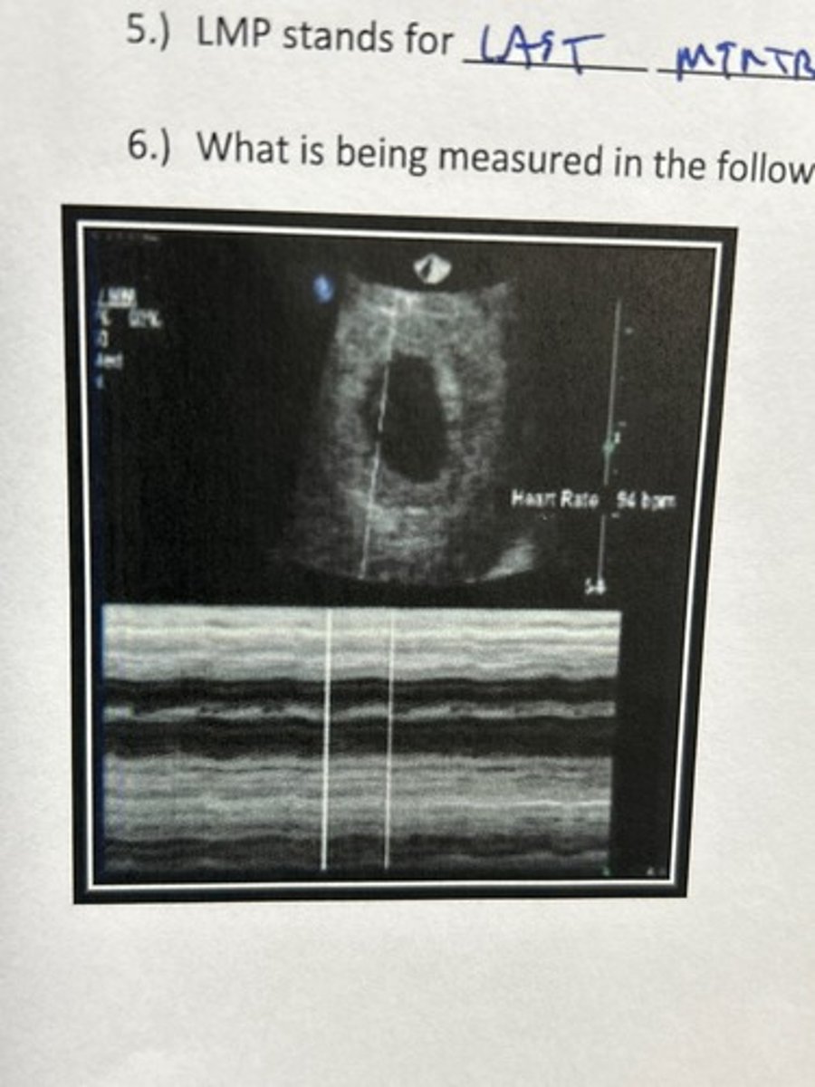 <p>Fetal HT</p>
