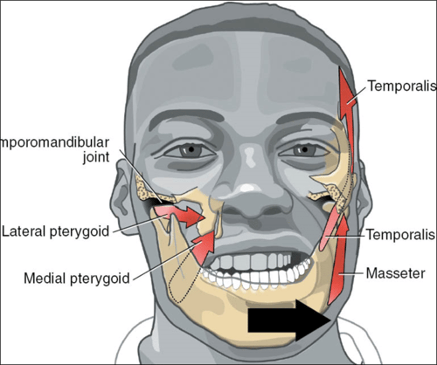 <p>Contralateral Pterygoids </p><p>+</p><p>Ipsilateral </p><p>- temporalis</p><p>- masseter</p>