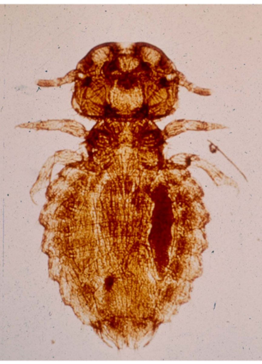 <p>What type of louse is this?</p>