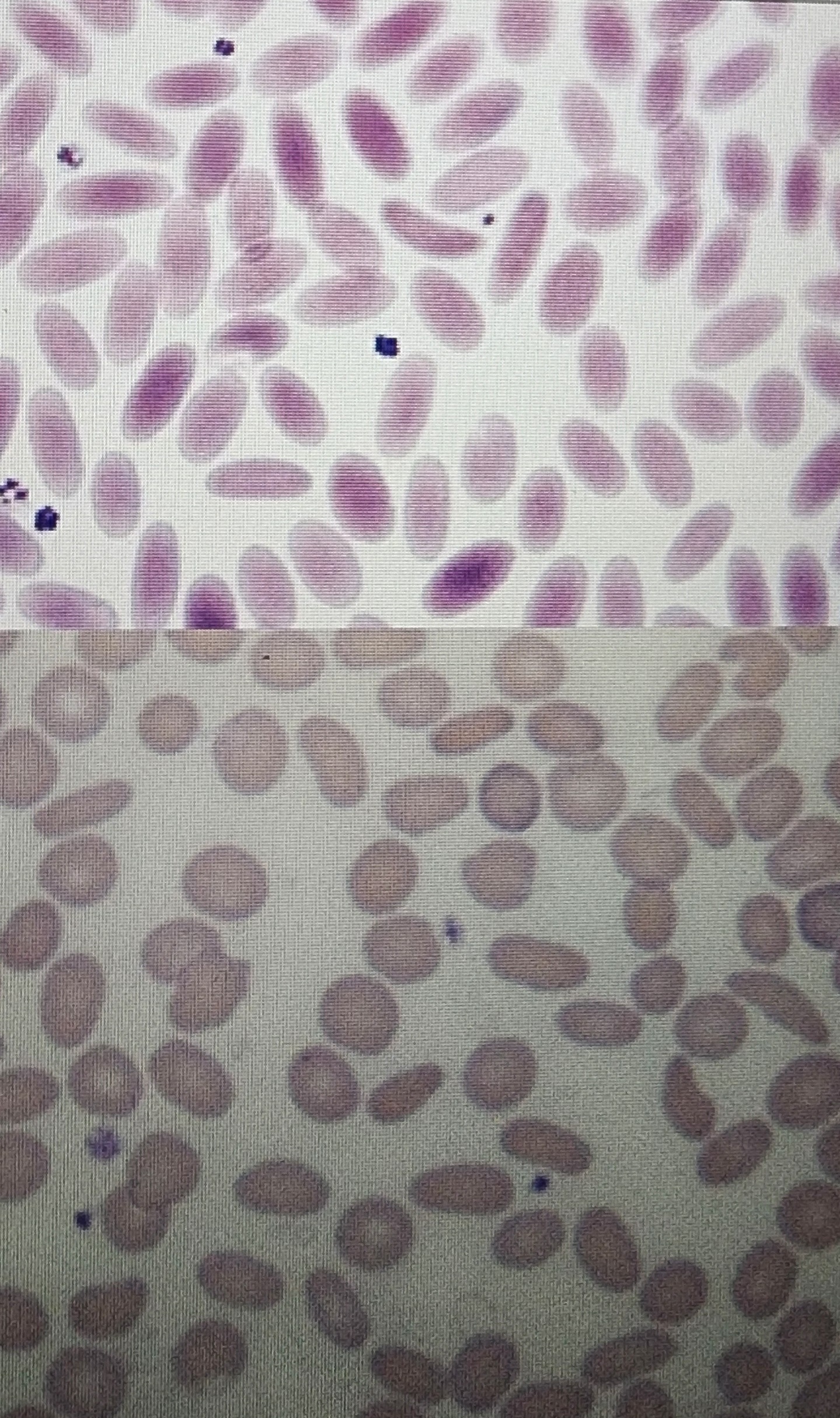 <p>Ovalocytes</p>