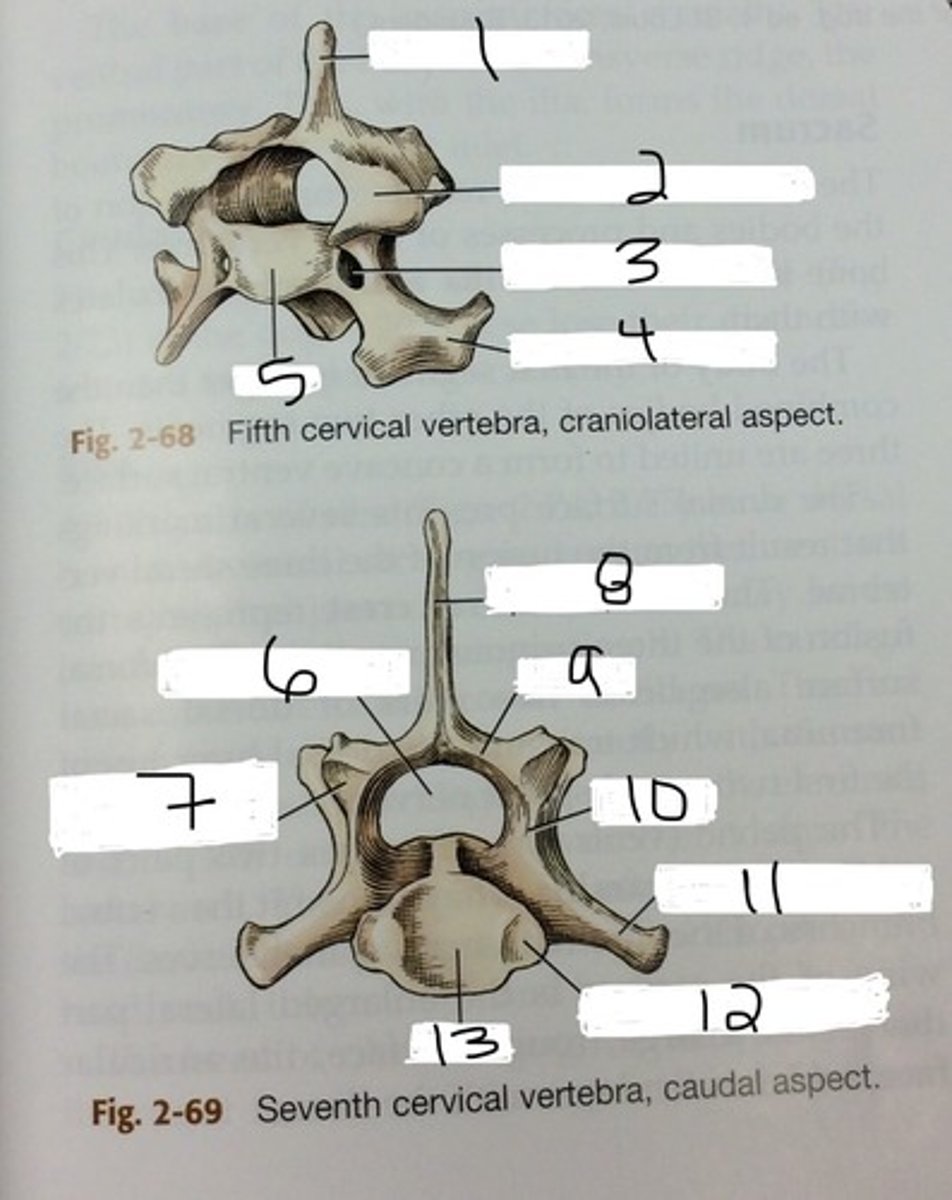 <p>projects dorsally, allows for flexion of trunk</p>