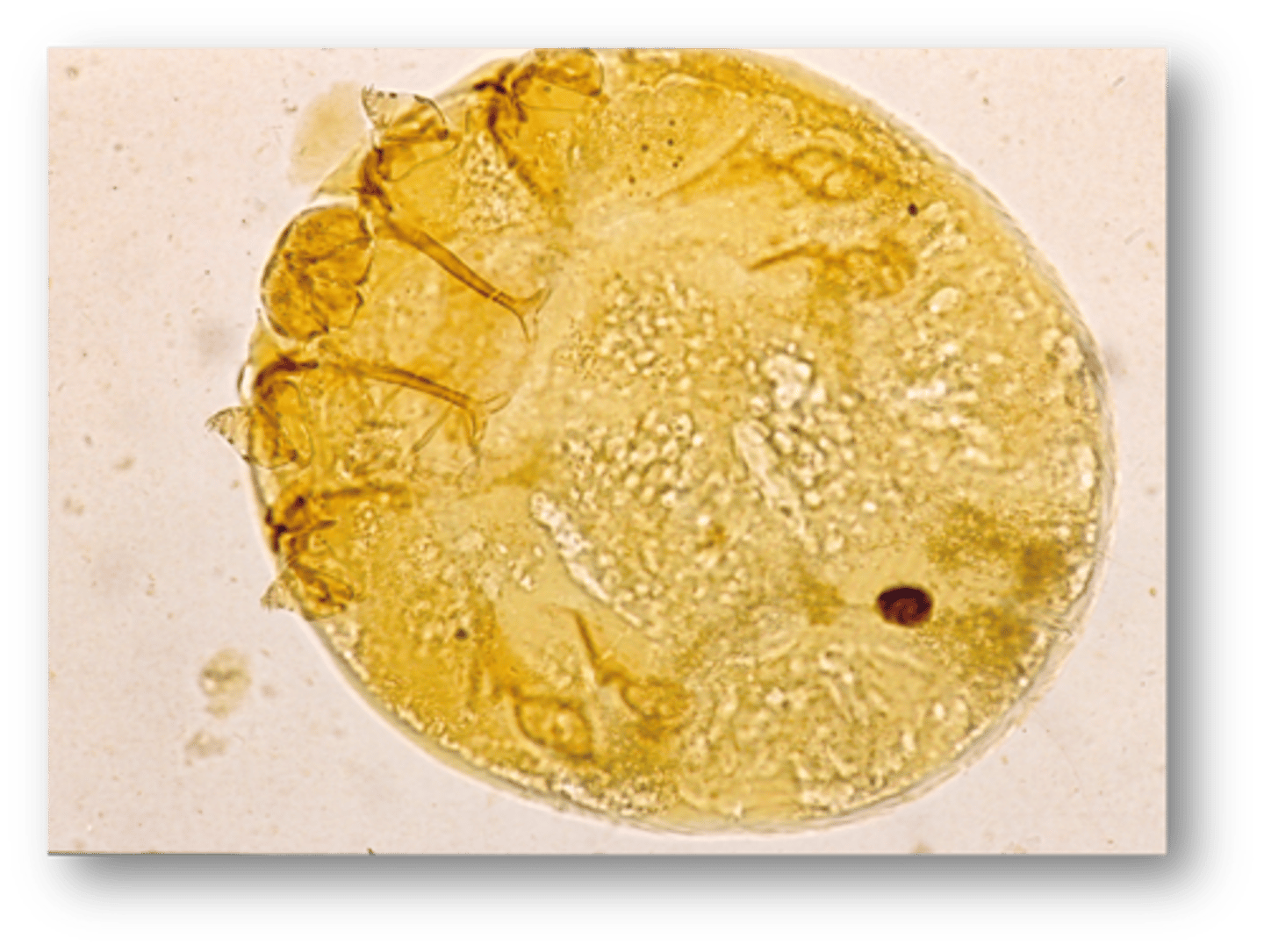 <p>Found on a chicken with intense scaling and crusting. What parasite is this?</p>