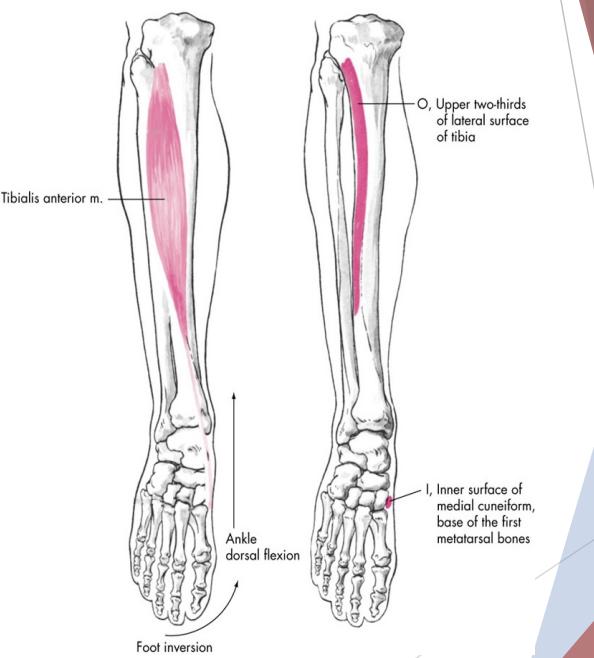 <p>Tibialis Anterior</p>