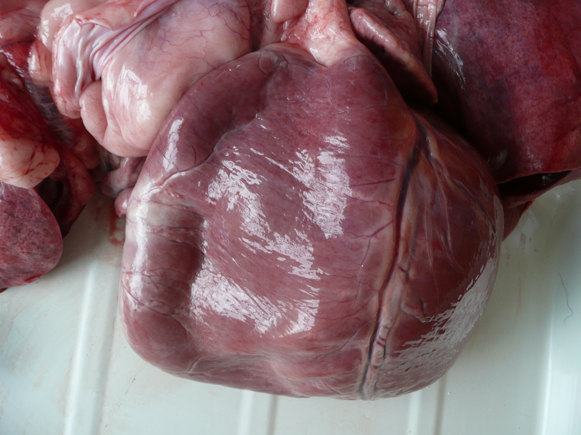 <p>What organ is this? Give a morphological description, morphological diagnosis, disease diagnosis, and possible cause</p>