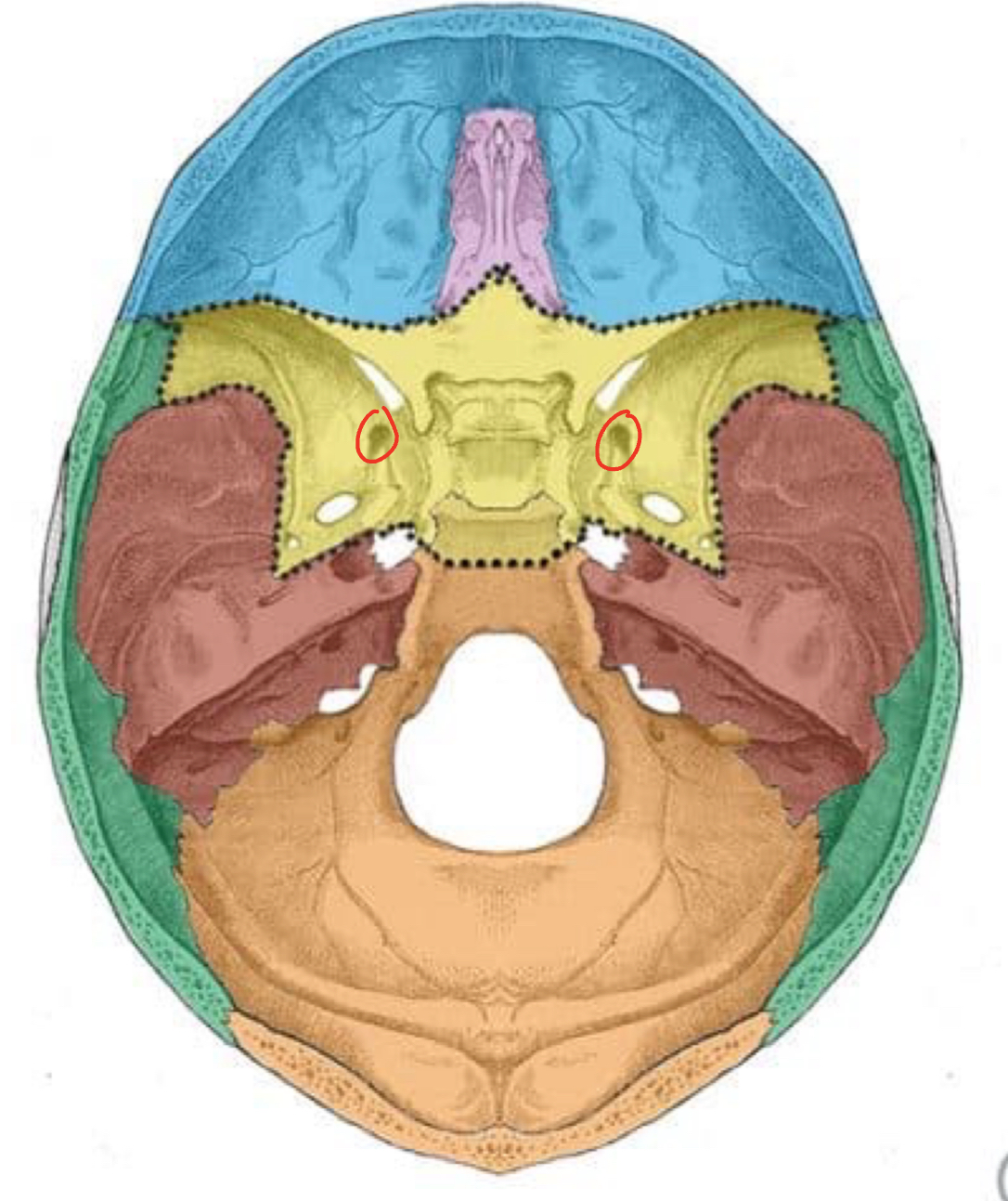 term image