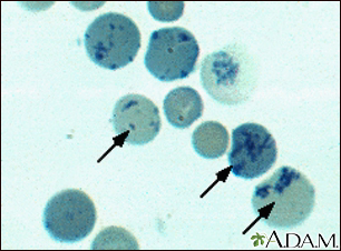<ul><li><p>size: 8 micrometers</p></li><li><p>appearance: large, bluish red cells, reminants of RNA visualized with methylene blue stain</p></li></ul><p></p>