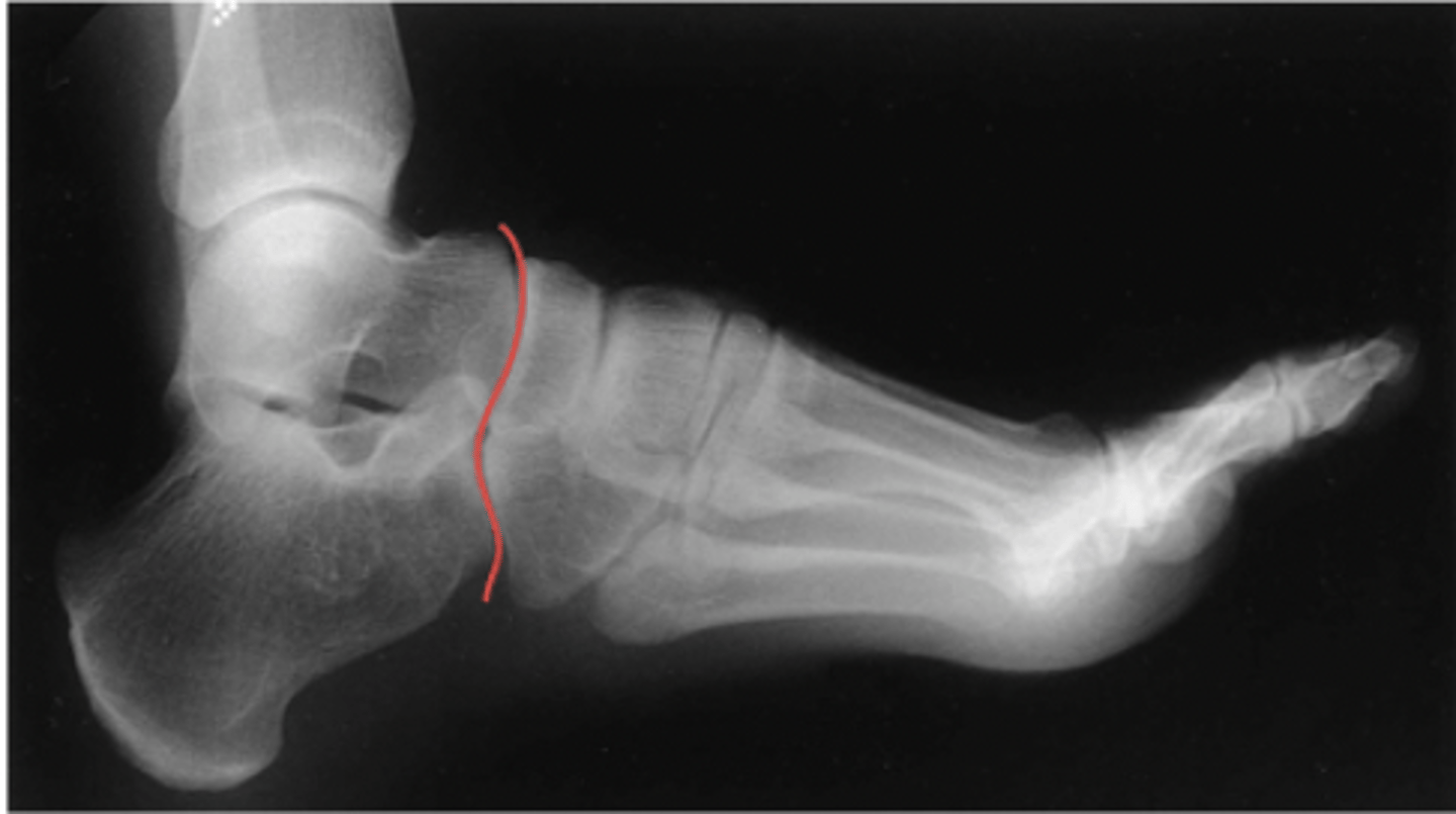 <p>What structure is highlighted?</p>