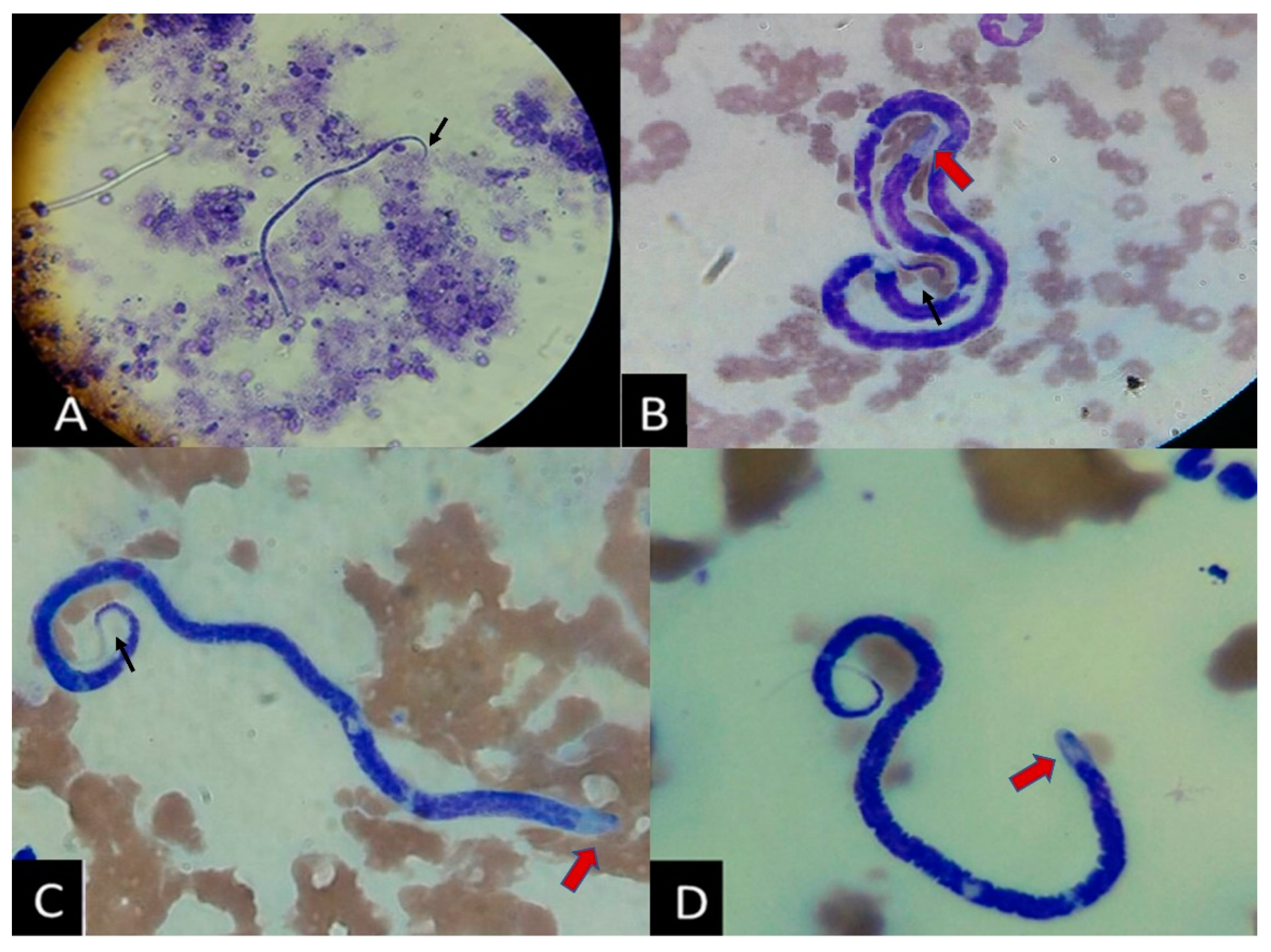 <p>Subcutaneous filarial worm, appears very similar to dirofilarial but contains a hooked posterior</p>