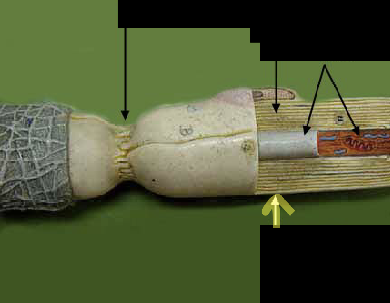 <p>What part of the neuron is this?</p>