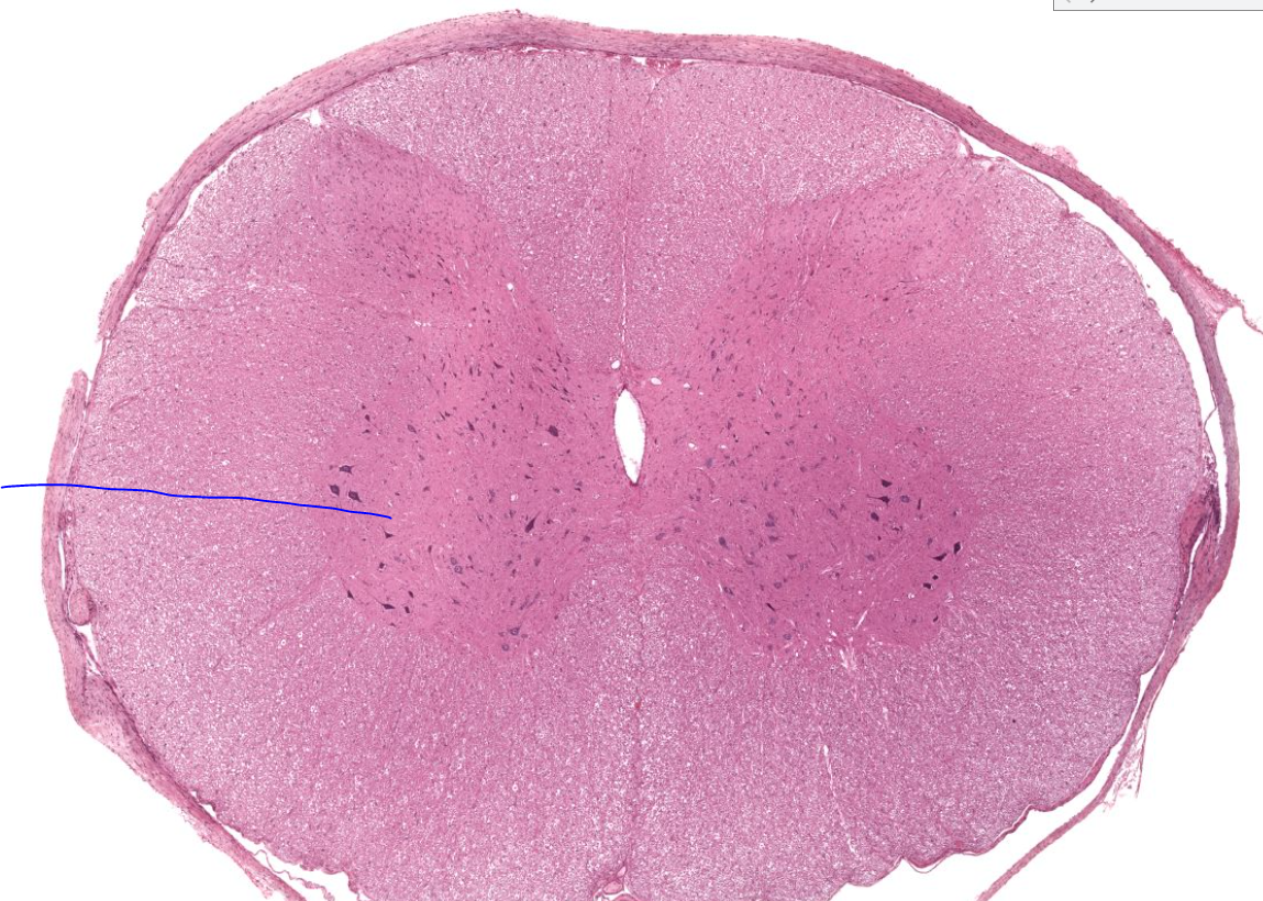 <p>lower wing of gray matter contain cell bodies of motor neurons </p>