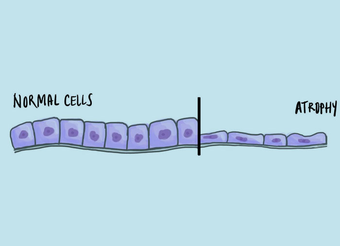 <p>Decrease in cell size</p>