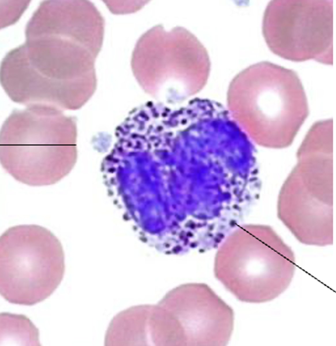 <p>Which leukocyte?</p>