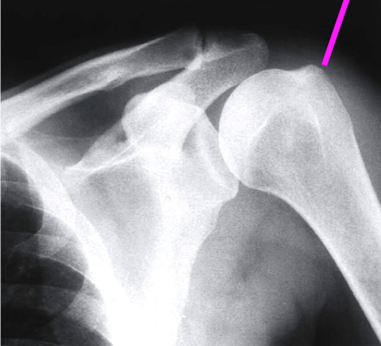 <p>what does the pink line point to?</p>