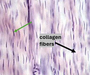 <p>What is the GREEN arrow pointing at?</p>